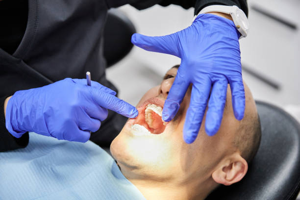 Best Emergency Root Canal Treatment in Hoschton, GA